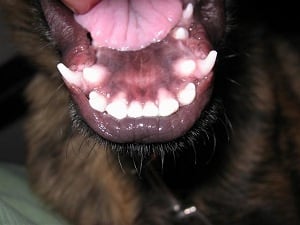 Задържани кучешки зъби