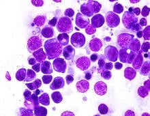 Протичане на болестите