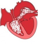 Етиология на дирофилариоза при кучето