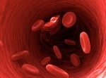 Местни разстройства на кръвообращението
